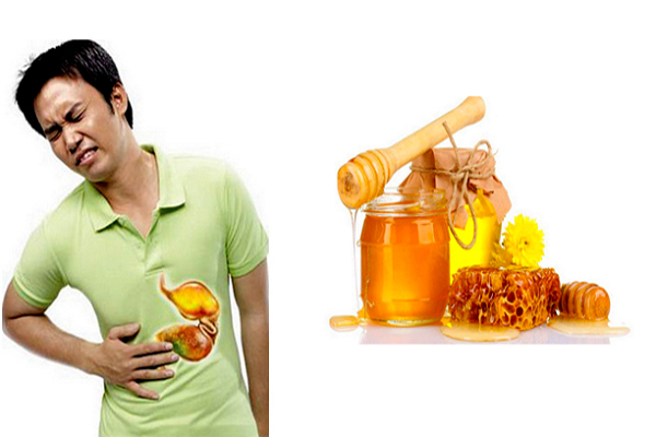 Bật mí một số cách chữa bệnh đau dạ dày bằng mật ong